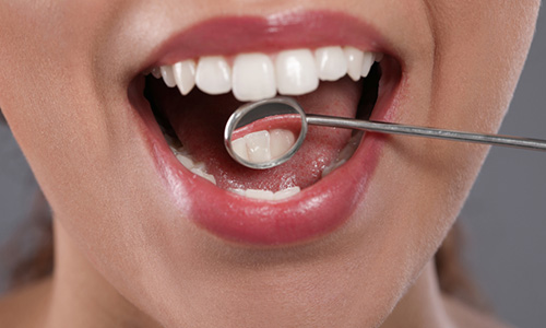 Periodontal Therapy